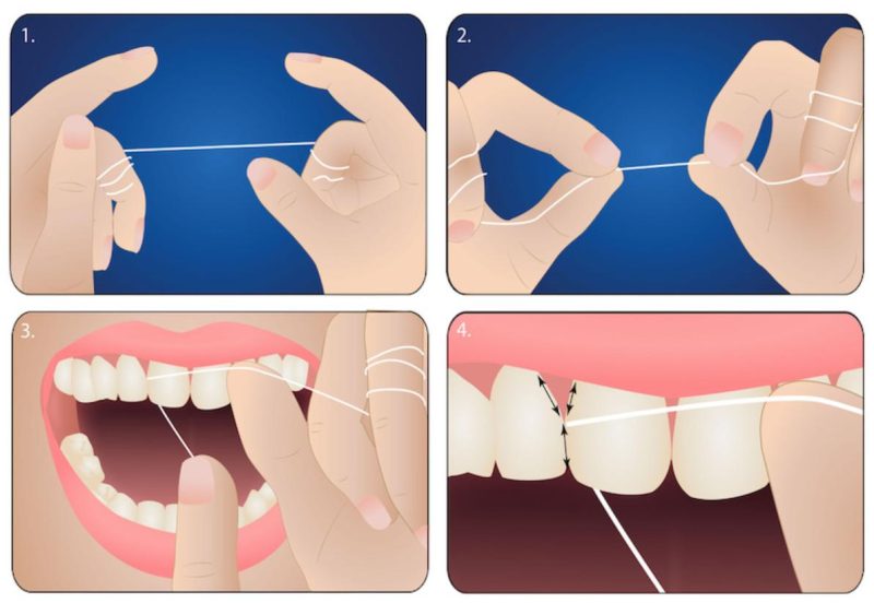 Cách dùng chỉ nha khoa đúng chuẩn