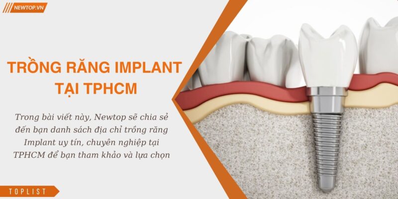trồng răng implant tại tphcm