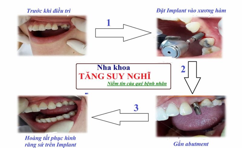 Nha khoa BS. Tăng Suy Nghĩ