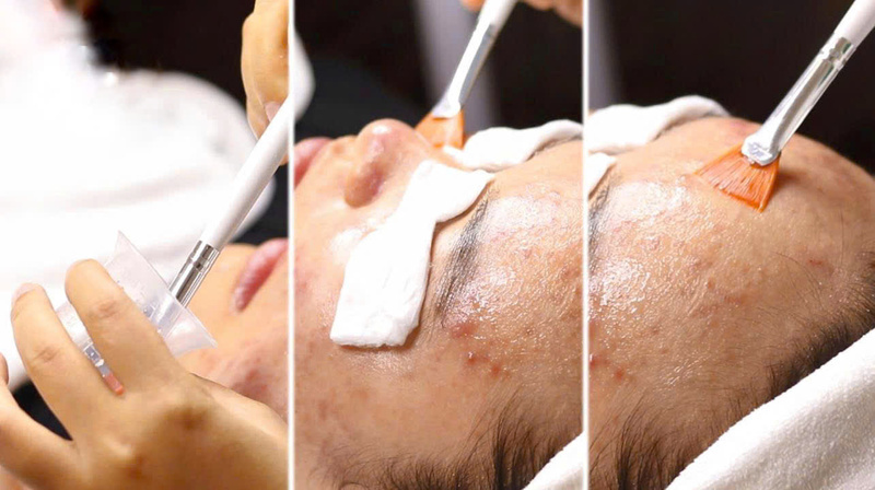 Mạ Beauty - Spa trị mụn uy tín TPHCM