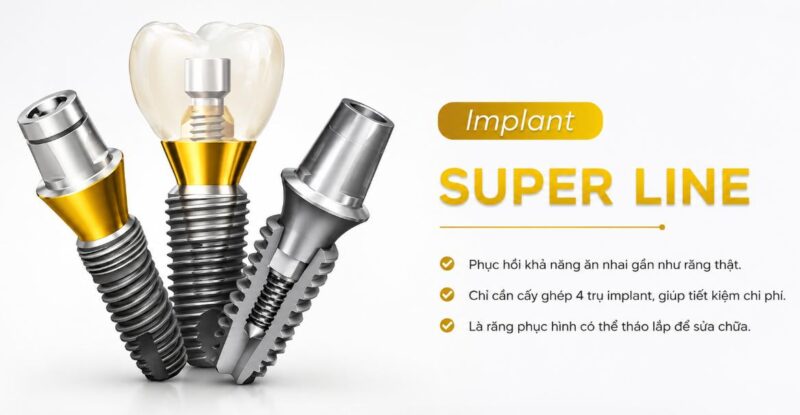 Trụ Implant Superline