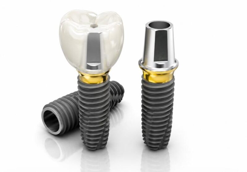Implant Dentium là một trong các trụ Implant tốt nhất hiện nay
