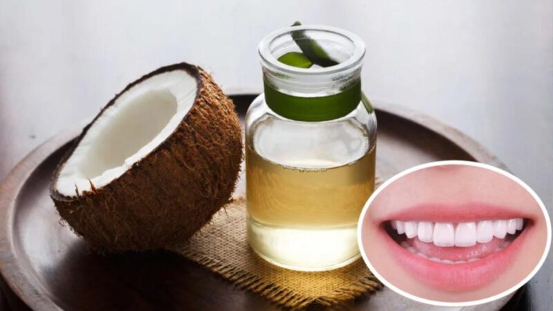 Dầu dừa đem lại khả năng diệt khuẩn rất tốt cho răng