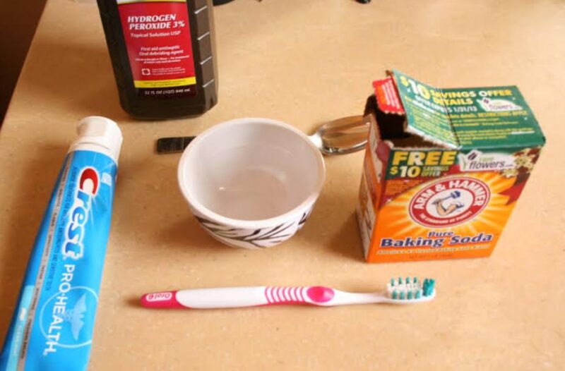 Làm trắng răng bằng baking soda và hydrogen peroxide là cách làm phổ biến