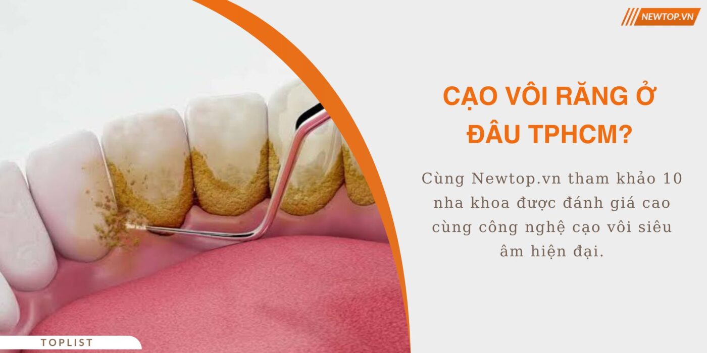 cạo vôi răng ở đâu tphcm