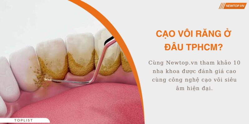 cạo vôi răng ở đâu tphcm