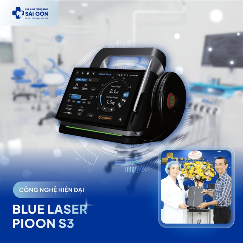 Công nghệ SmartLaser Blue Laser S3