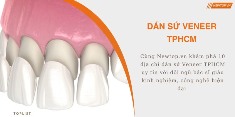 dán sứ veneer tphcm