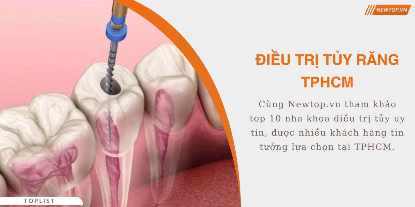 điều trị tủy răng tphcm