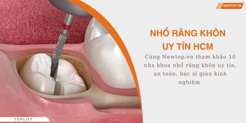 nhổ răng khôn uy tín hcm