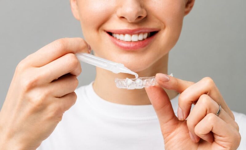 Cách dùng thuốc tẩy trắng răng tại nhà hiệu quả