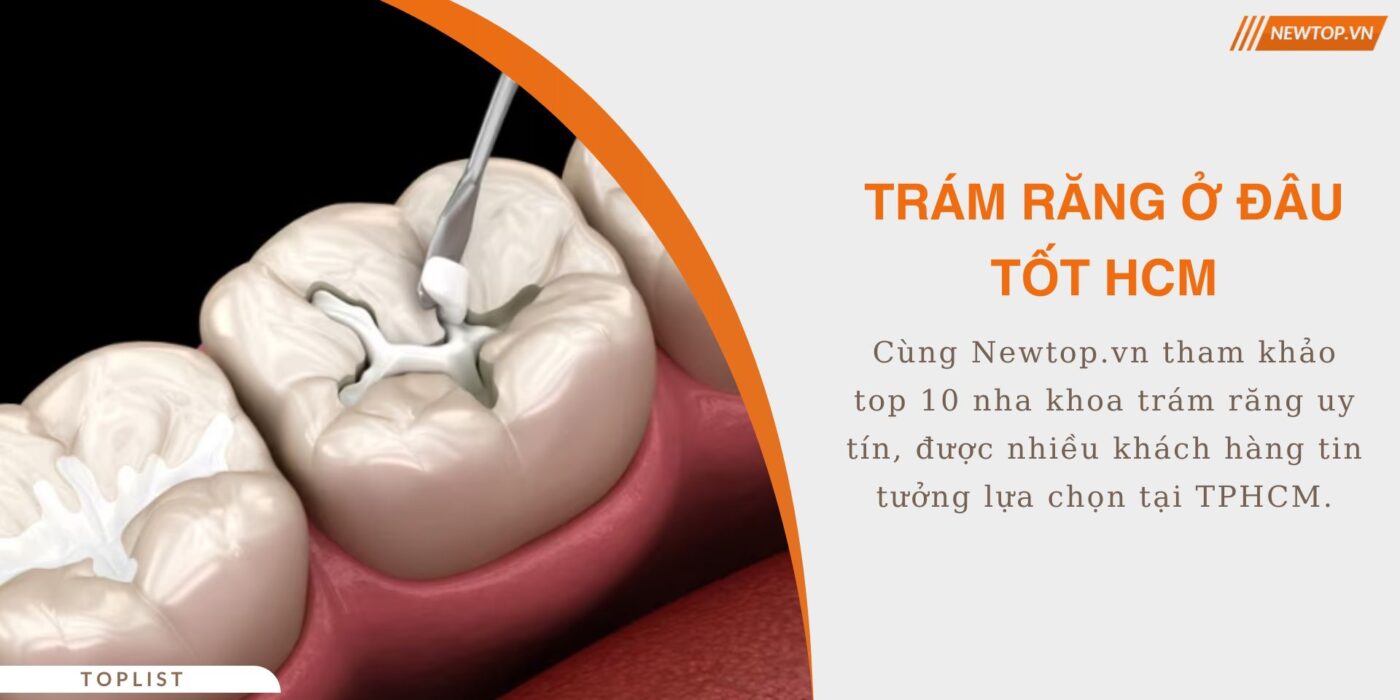 trám răng ở đâu tốt HCM