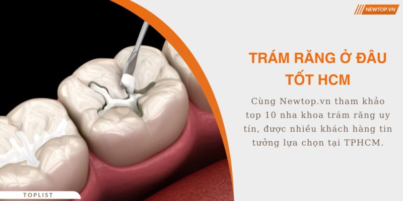 trám răng ở đâu tốt HCM